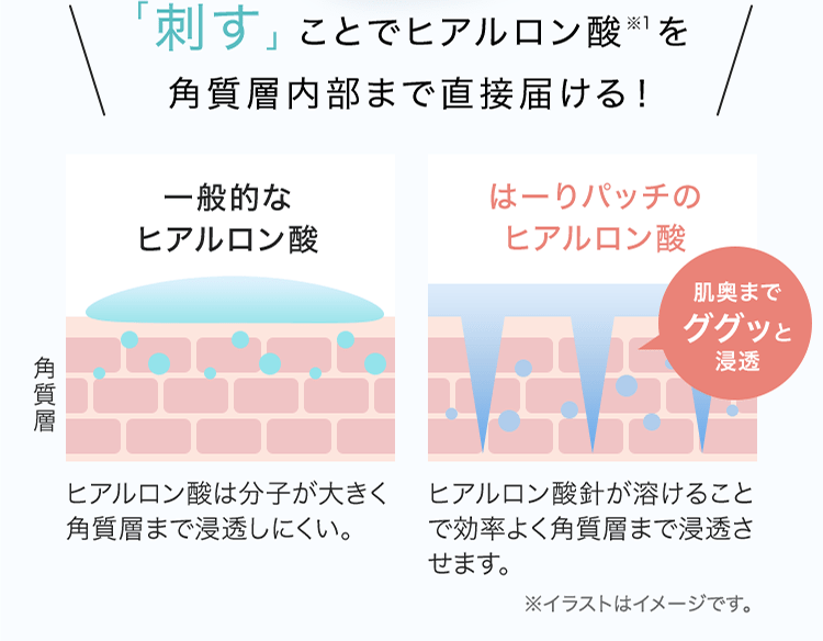 「刺す」ことでヒアルロン酸※1を角質層内部まで直接届ける！ はーりパッチのヒアルロン酸 ヒアルロン酸針が溶けることで効率よく角質層まで浸透させます。 ※イラストはイメージです。