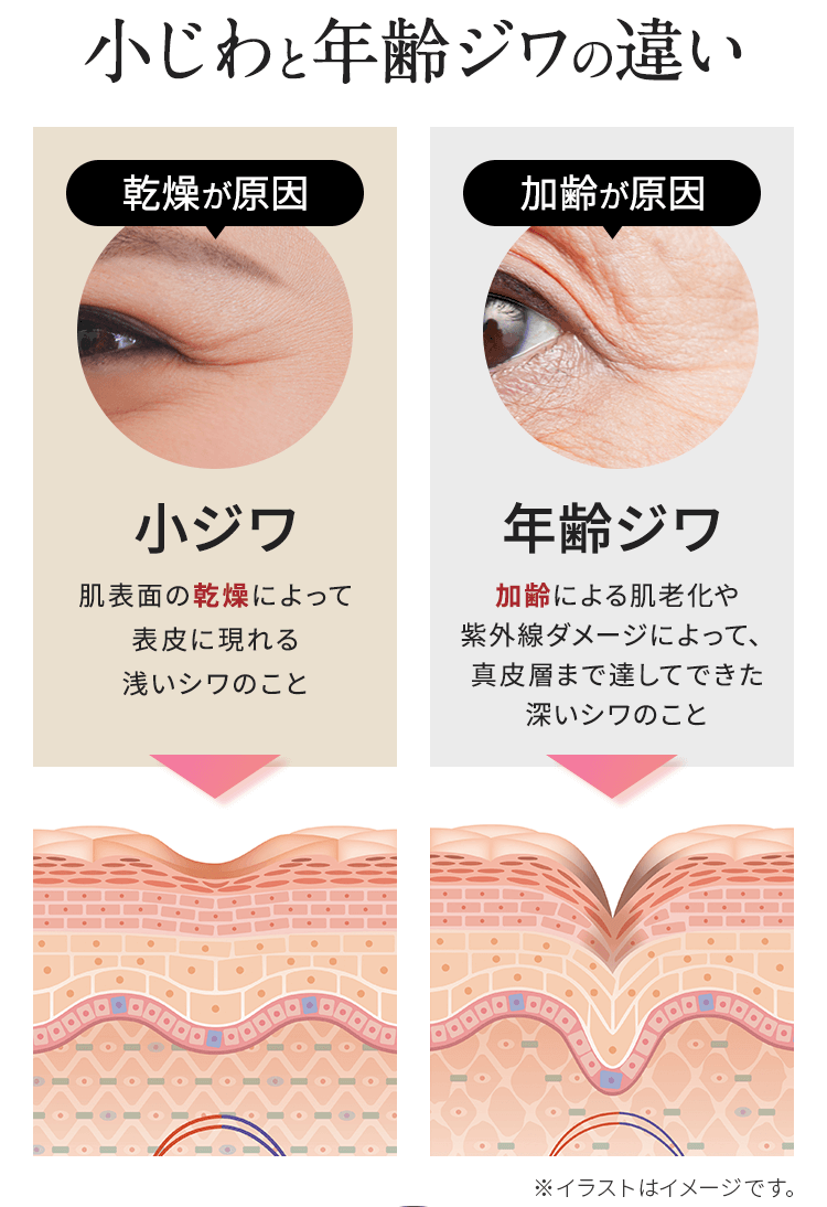 小じわと年齢ジワの違い 乾燥が原因 小ジワ 加齢が原因 年齢ジワ