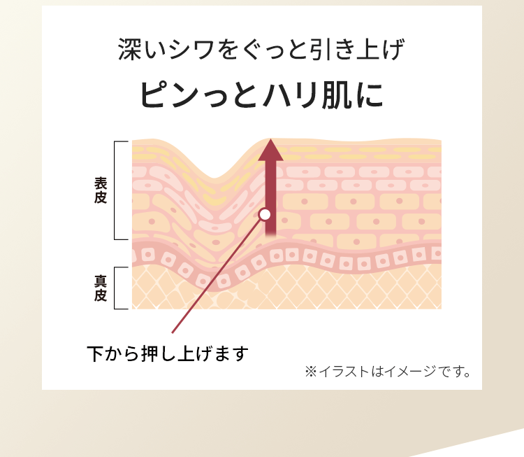 深いシワをぐっと引き上げピンっとハリ肌に