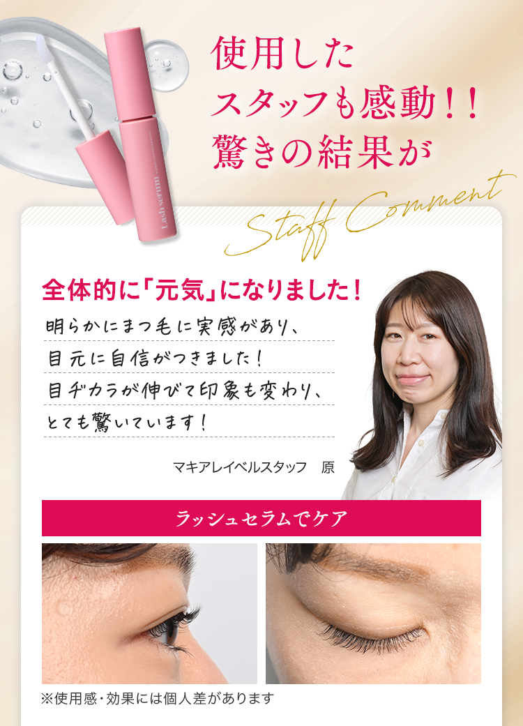Amazon.co.jp: 【美容クリニック共同開発】ベルフラッシュ