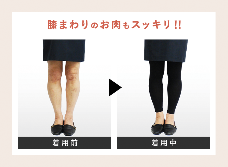 膝まわりのお肉もスッキリ！！