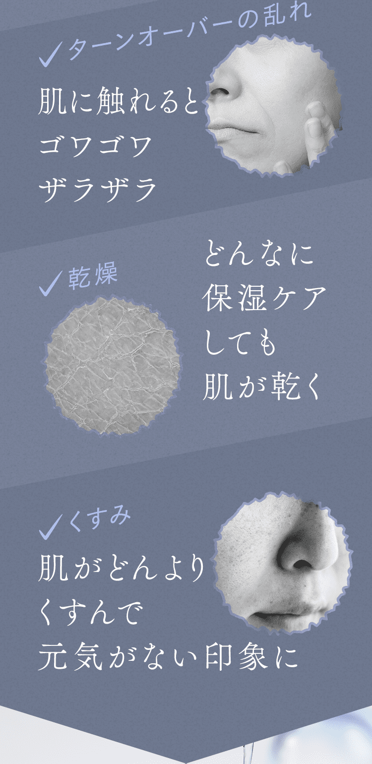 ターンオーバーの乱れ、乾燥、くすみ
