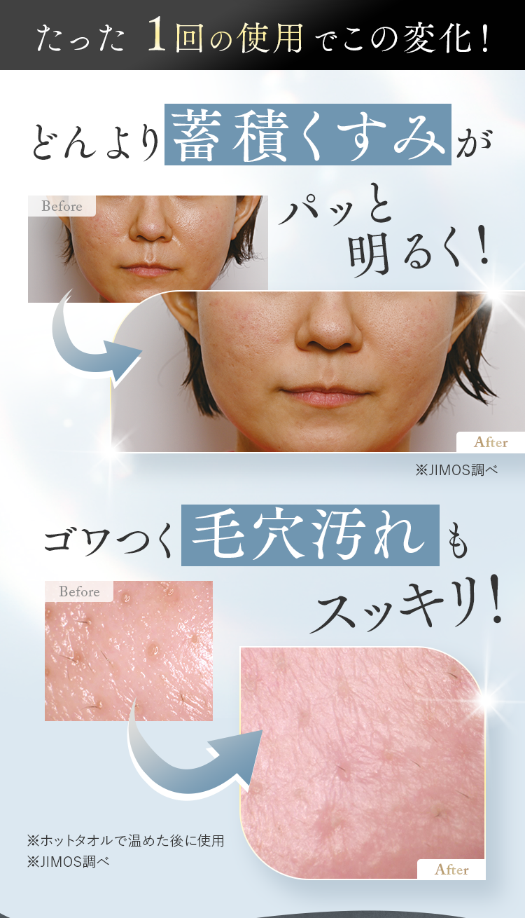 たった1回の使用でこの変化！｜どんより蓄積くすみがパッと明るく！・ゴワつく 毛穴汚れもスッキリ！