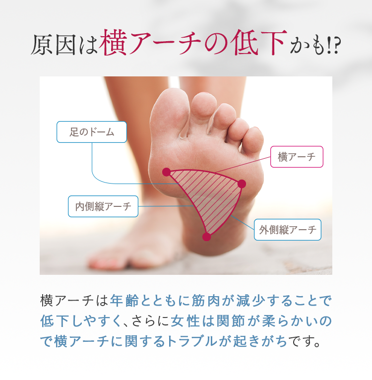 原因は横アーチの低下かも!?