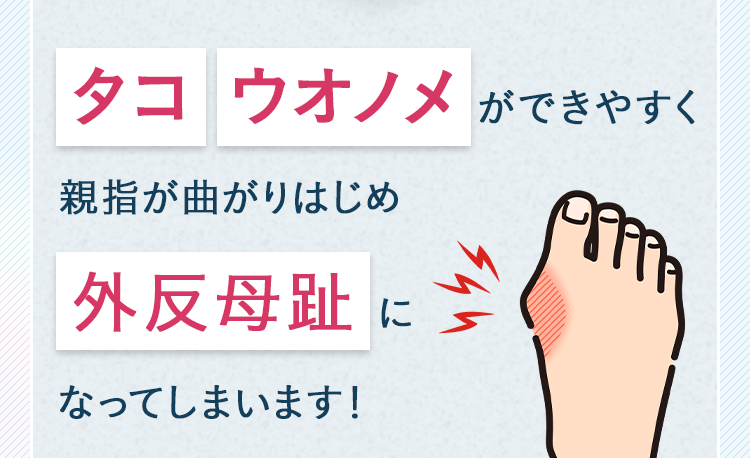 タコ・ウオノメができやすく親指が曲がりはじめ外反母趾になってしまいます！