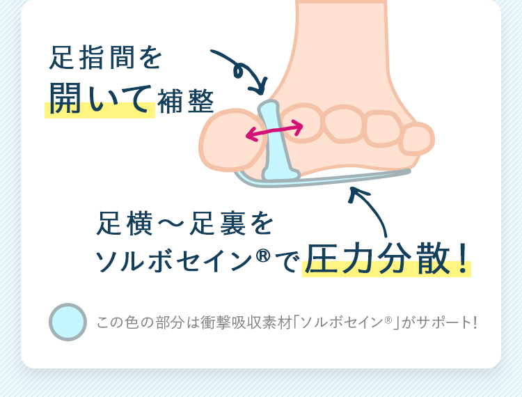 足指間を開いて補整 足横～足裏をソルボセイン&reg;で圧力分散！