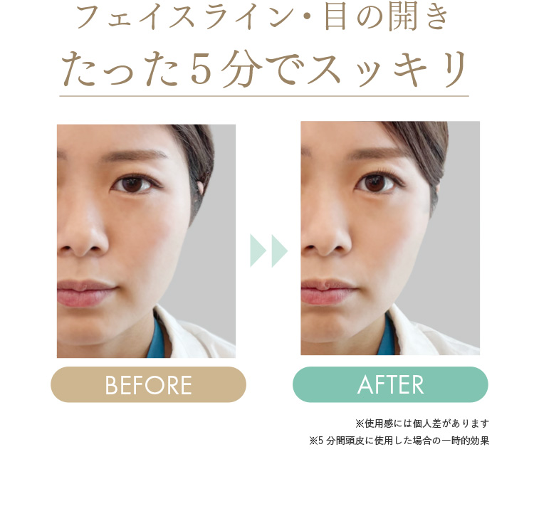 フェイスライン・目の開きたった5分でスッキリ
