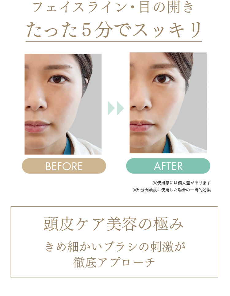 フェイスライン・目の開きたった5分でスッキリ 頭皮ケア美容の極みきめ細かいブラシの刺激が徹底アプローチ