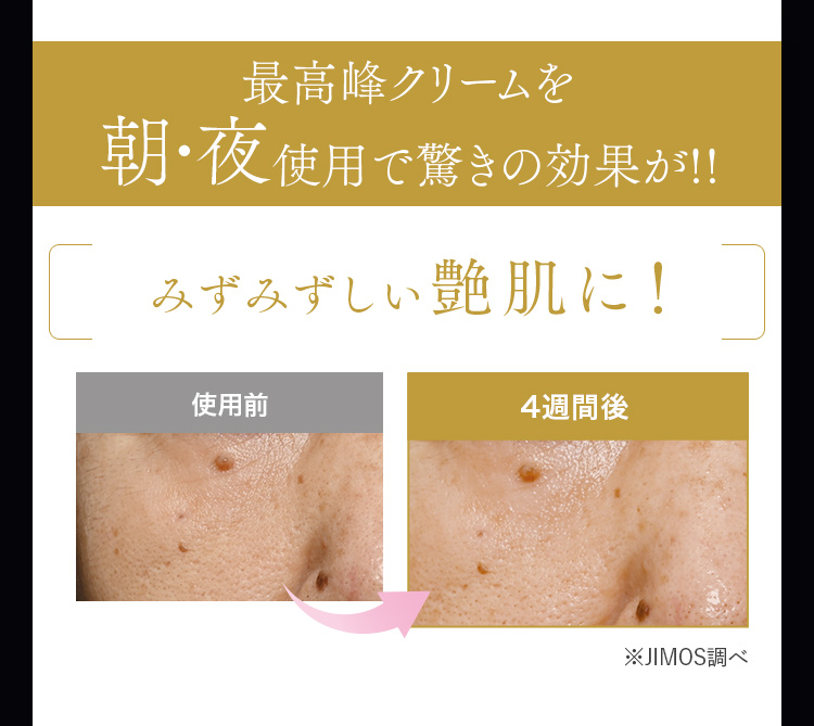 最高峰クリームを朝･夜使用で驚きの効果が!! みずみずしい艶肌に！