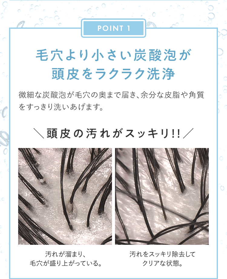 POINT1 毛穴より小さい炭酸泡が頭皮をラクラク洗浄